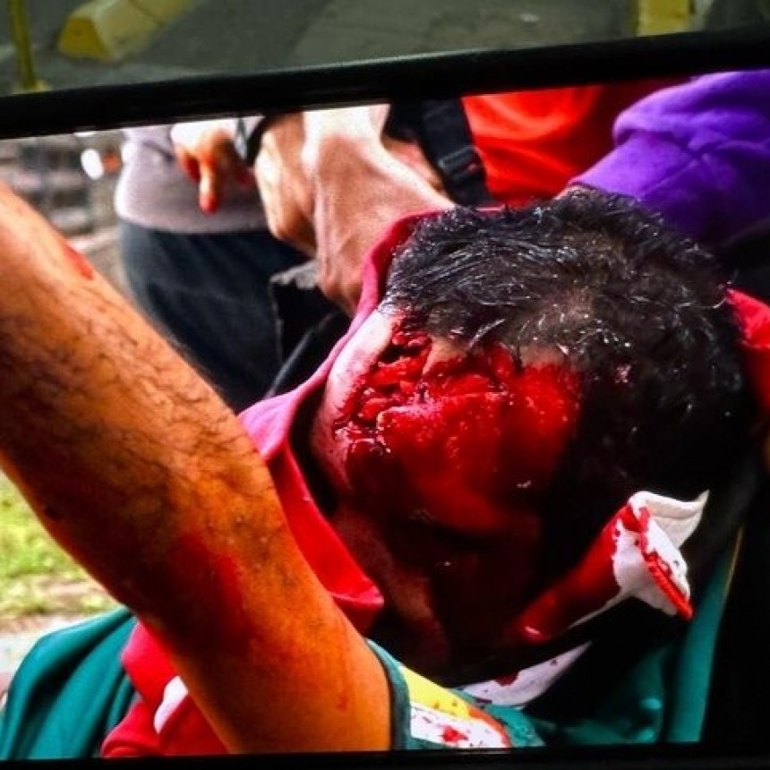 BRUTAL REPRESION 